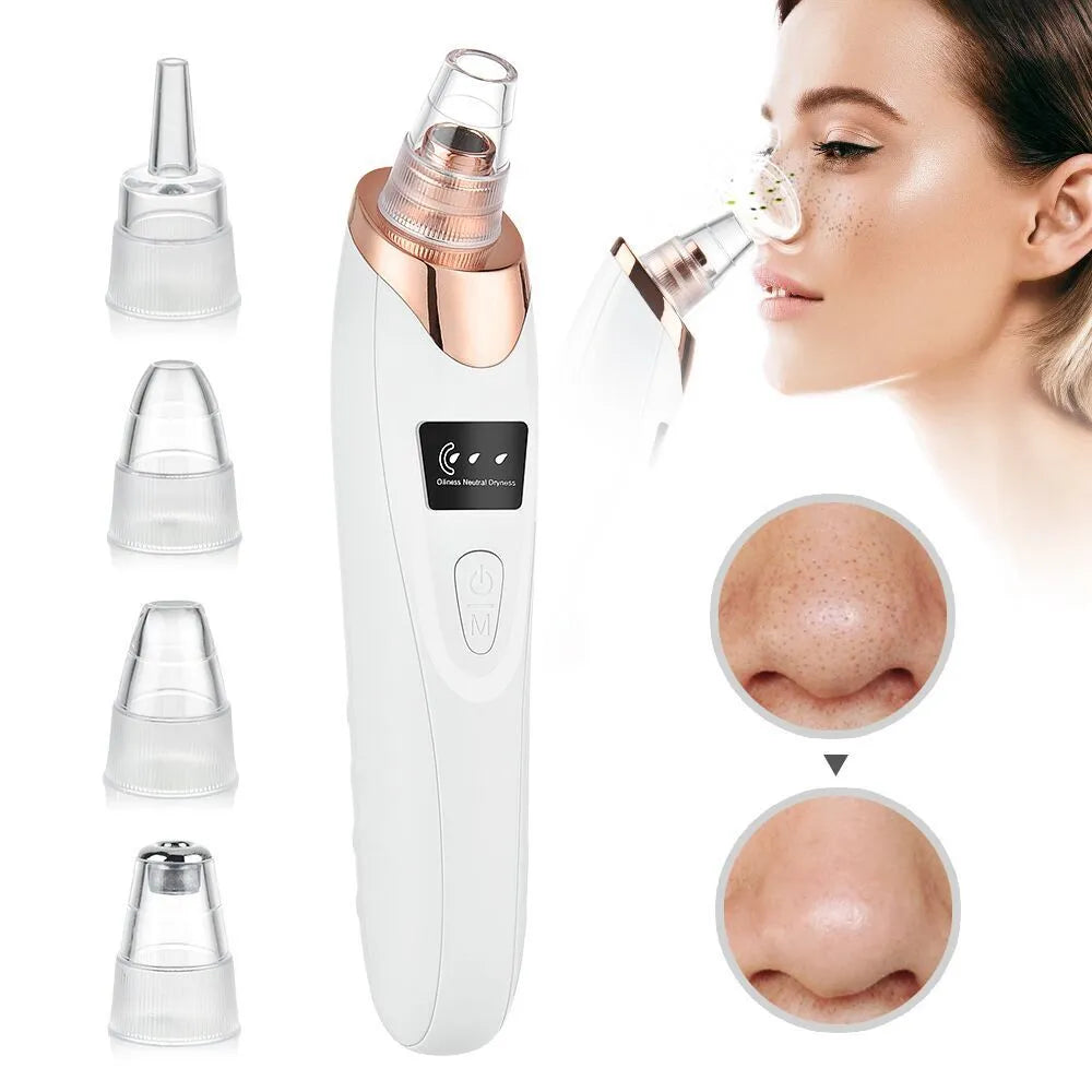 Electric Blackhead Remover & Facial Pore Vacuum